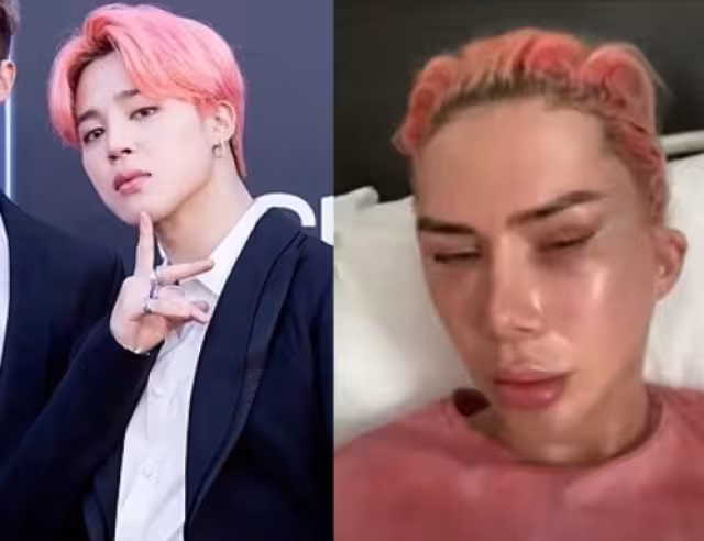 Joven asume la identidad de coreano tras hacerse cirugías para parecerse a Jimin de BTS