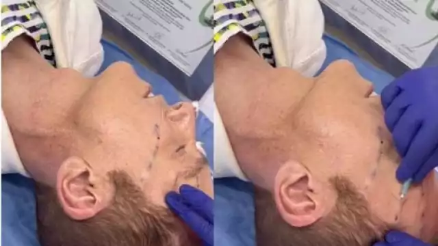 Daniel Bisogno se operó para verse más joven