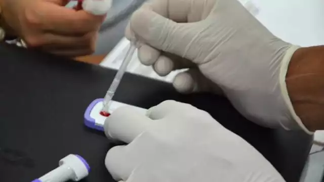 Casos de virus de inmunodeficiencia humana alcanzan los 571, en lo que va del año, con 27 nuevos registros en una semana y un crecimiento del 7.5%, según el Sinave