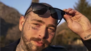Post Malone gasta más de un millón de dólares en su sonrisa