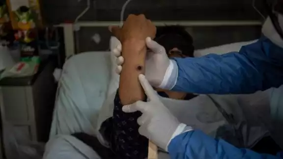 Las autoridades sanitarias cubanas informaron que al paciente se le diagnosticó la enfermedad el pasado 20 de agosto Las autoridades sanitarias cubanas informaron que al paciente se le diagnosticó la enfermedad el pasado 20 de agosto