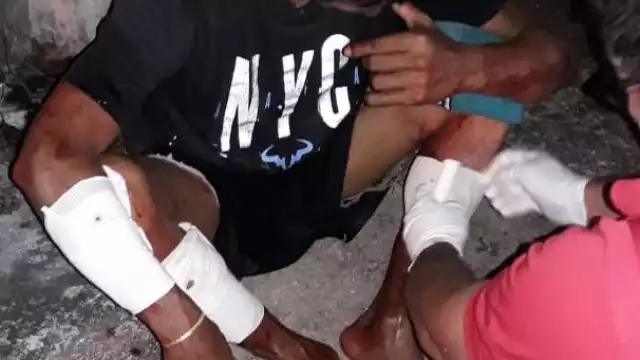 los perros atacaron al masculino cuando este ingresó al patio de la vivienda, generándole diversas lesiones en pantorrillas y brazos