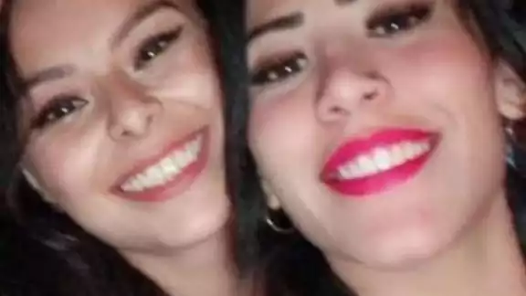 Ambas se encuentran en el Hospital General de Xoco en CDMX