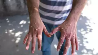 A nivel peninsular, el Estado supera a Yucatán, que ayer reportó 137 contagios y Campeche 11