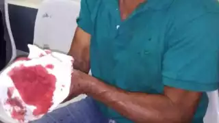 El hombre fue atacado por dos sujetos, uno portaba un cuchillo con el que lo lesionó