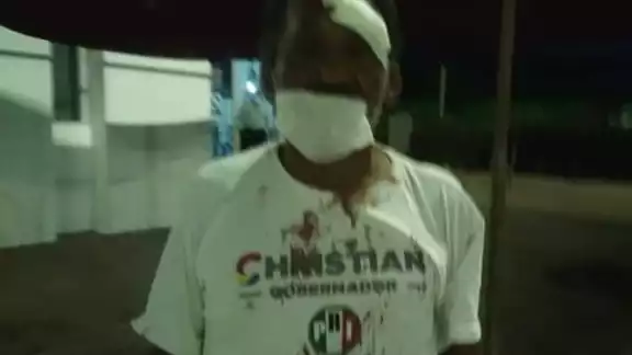 “La Mona”, fue lesionado en una ceja, ya que existen muchos antecedentes en contra del mismo “La Mona”, fue lesionado en una ceja, ya que existen muchos antecedentes en contra del mismo