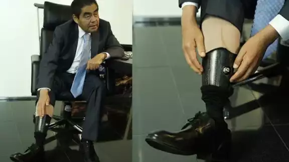 Este fue el motivo porque el Miguel Barbosa perdió la pierna Este fue el motivo porque el Miguel Barbosa perdió la pierna