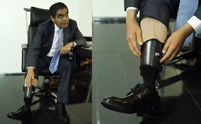 Este fue el motivo porque el Miguel Barbosa perdió la pierna