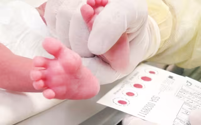 Con el estudio del tamiz es posible detectar hasta 67 enfermedades congénitas en recién nacidos de manera temprana, indican especialistas