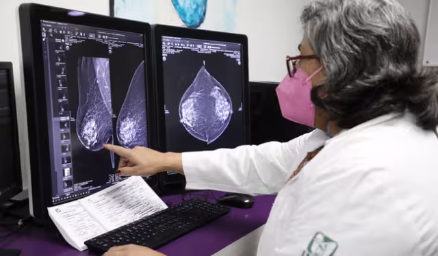 Yucatán está por debajo de la media en mortalidad por cáncer