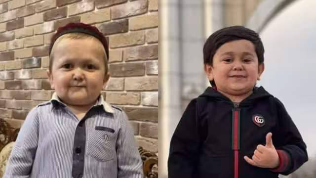 El influencer ruso padece acondroplasia y aparenta mucho menos de la edad que tiene