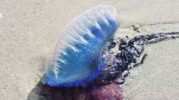 Una picadura de 'agua mala' puede ocasionar quemaduras, problemas respiratorios o la muerte Una picadura de 'agua mala' puede ocasionar quemaduras, problemas respiratorios o la muerte