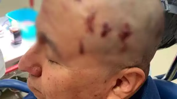 El video muestra como el luchador toma al árbitro y comienza a picarlo con el puñal