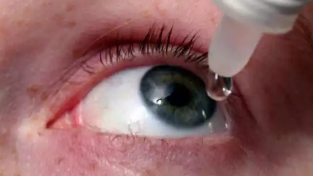 La enfermedad consiste en una inflamación de la membrana que cubre parte de los ojos