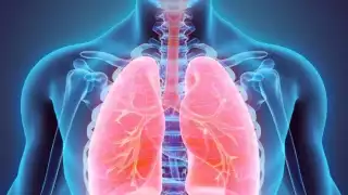 La tuberculosis afecta el sistema respiratorio