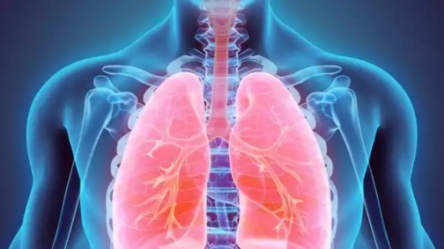 La tuberculosis afecta el sistema respiratorio