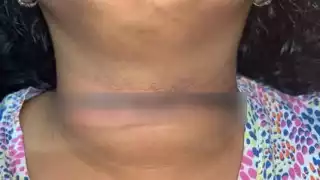 “Casi me mata”: Mujer estuvo a punto de perder la cabeza por un cable colgado en una calle de Ciudad Caucel en Mérida 