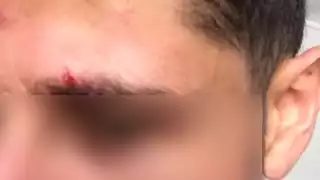 Los hechos ocurrieron a las afueras del establecimiento de comida conocido como "Tacos el Fogón", sobre la Av. 30