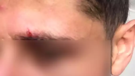 Los hechos ocurrieron a las afueras del establecimiento de comida conocido como "Tacos el Fogón", sobre la Av. 30