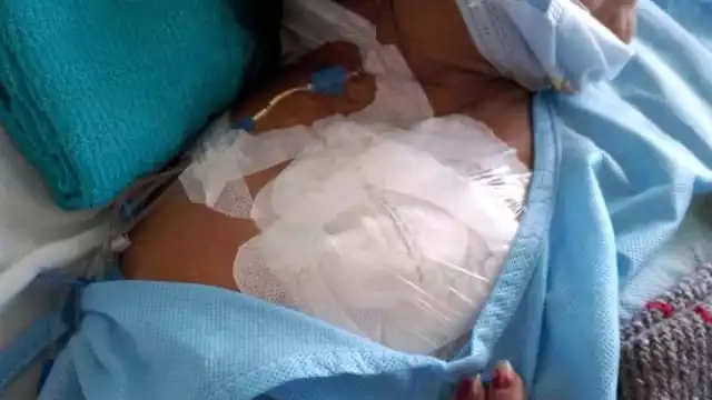 La mujer ha sido operada en dos ocasiones de los riñones, por lo que agotó los pocos ahorros que tenía.