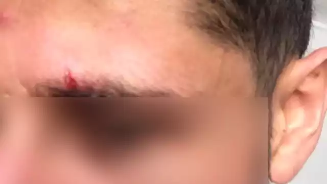 Los hechos ocurrieron a las afueras del establecimiento de comida conocido como "Tacos el Fogón", sobre la Av. 30