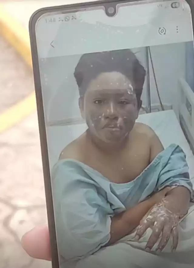 Menor quemado por un petardo en Xul-Ha será trasladado a CDMX