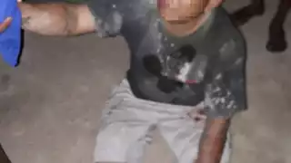 Pese a las lesiones, el herido no perdió ningún dedo