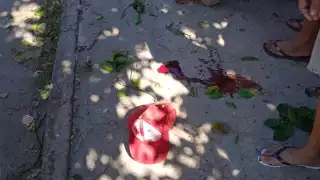 A pesar de que la altura no superaba el metro y medio, la caída fue recibida en la parte trasera de la cabeza