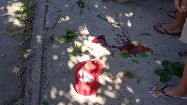 A pesar de que la altura no superaba el metro y medio, la caída fue recibida en la parte trasera de la cabeza