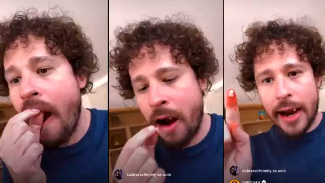 Luisito Comunica explicó a sus seguidores el motivo de que haya perdido sus dientes