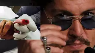 El actor Johnny Depp perdió parte de su dedo en un pelea con su exesposa Amber Heard