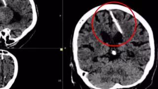 Los médicos aseguran que sus papás intentaron matarla cuando era bebé