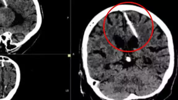 Los médicos aseguran que sus papás intentaron matarla cuando era bebé