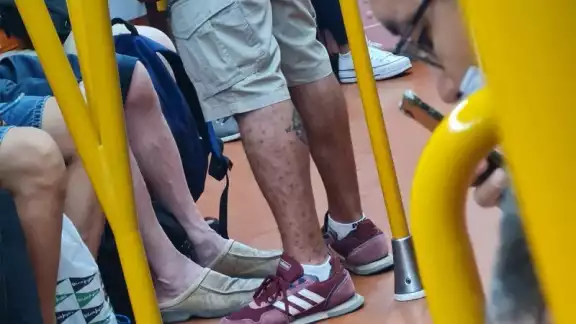 De acuerdo a los especialistas, los contagiados con viruela del mono deben aislarse. Foto: Twitter