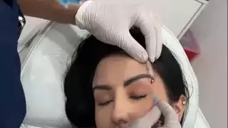 Así es como estiran la cara con los hilos, está de impacto: VIDEO