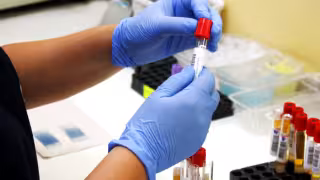 Hepatitis bajo vigilancia: Quintana Roo registra 24 casos en 2026