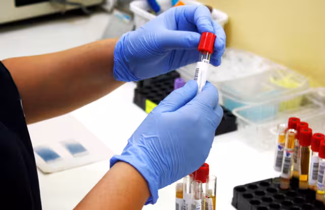 Alerta epidemiológica: hepatitis A y B presentes en la entidad