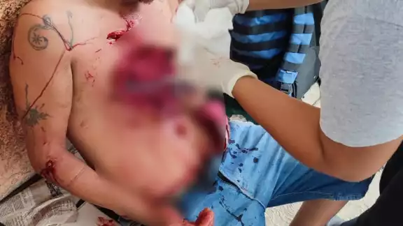 El hombre tuvo que ser trasladado al Hospital General de Chetumal