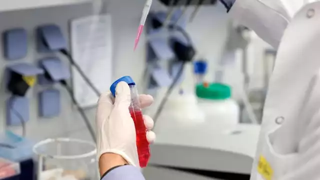 Científicos de Malasia detectaron la cepa D614G (EFE)