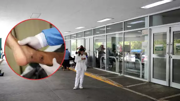 El padecimiento es provocado por un insecto pequeño, el cual transmite un parásito y genera heridas abiertas en la piel que tardan en sanar El padecimiento es provocado por un insecto pequeño, el cual transmite un parásito y genera heridas abiertas en la piel que tardan en sanar