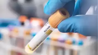 La mayoría de los casos se registran en Europa, sobre todo en el Reino Unido