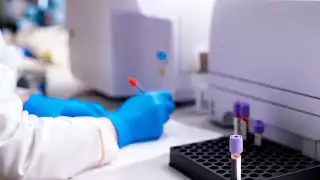 Al año se detectan 75 nuevos casos del tumor maligno en los menores