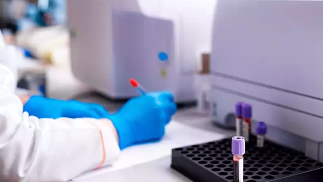 En Israel han descubierto un bloqueador que podría inhibir la metástasis en el cáncer de mama