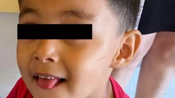 Muere un niño de 3 años durante una visita al dentista Muere un niño de 3 años durante una visita al dentista