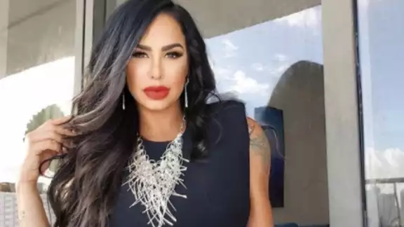 Liz Vega afirmó que el cambio en sus labios fue por un accidente que sufrió mientras trabajaba