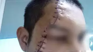 Los hechos ocurrieron cerca de una vivienda localizada en Altos de Sevilla con Primero de Mayo