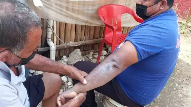 Durante más de 25 años ha atendido problemas de luxaciones, esguinces, torceduras, dolor de columna, lesiones por caídas y problemas de estrés