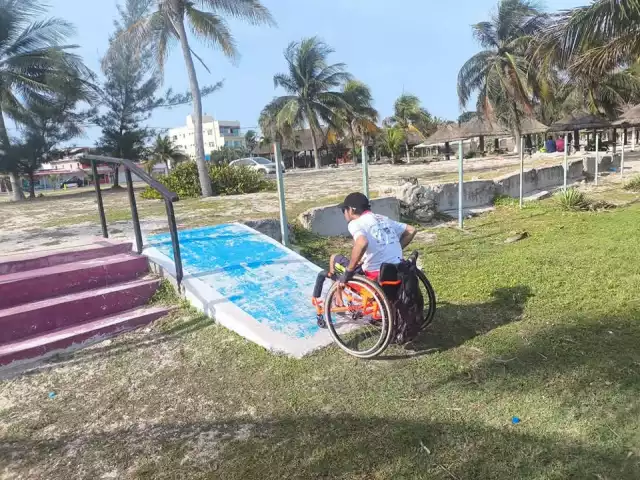 Las personas que pierden una extremidad pueden mejorar su vida con una prótesis.