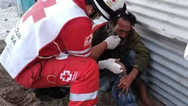 El hombre fue atacado con ácido en el cuerpo