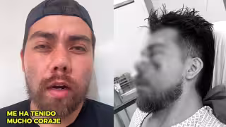 “Me atacaron por alimentar a animales de la calle”: Joven de Cancún denuncia a vecinos por presunta agresión y amenazas